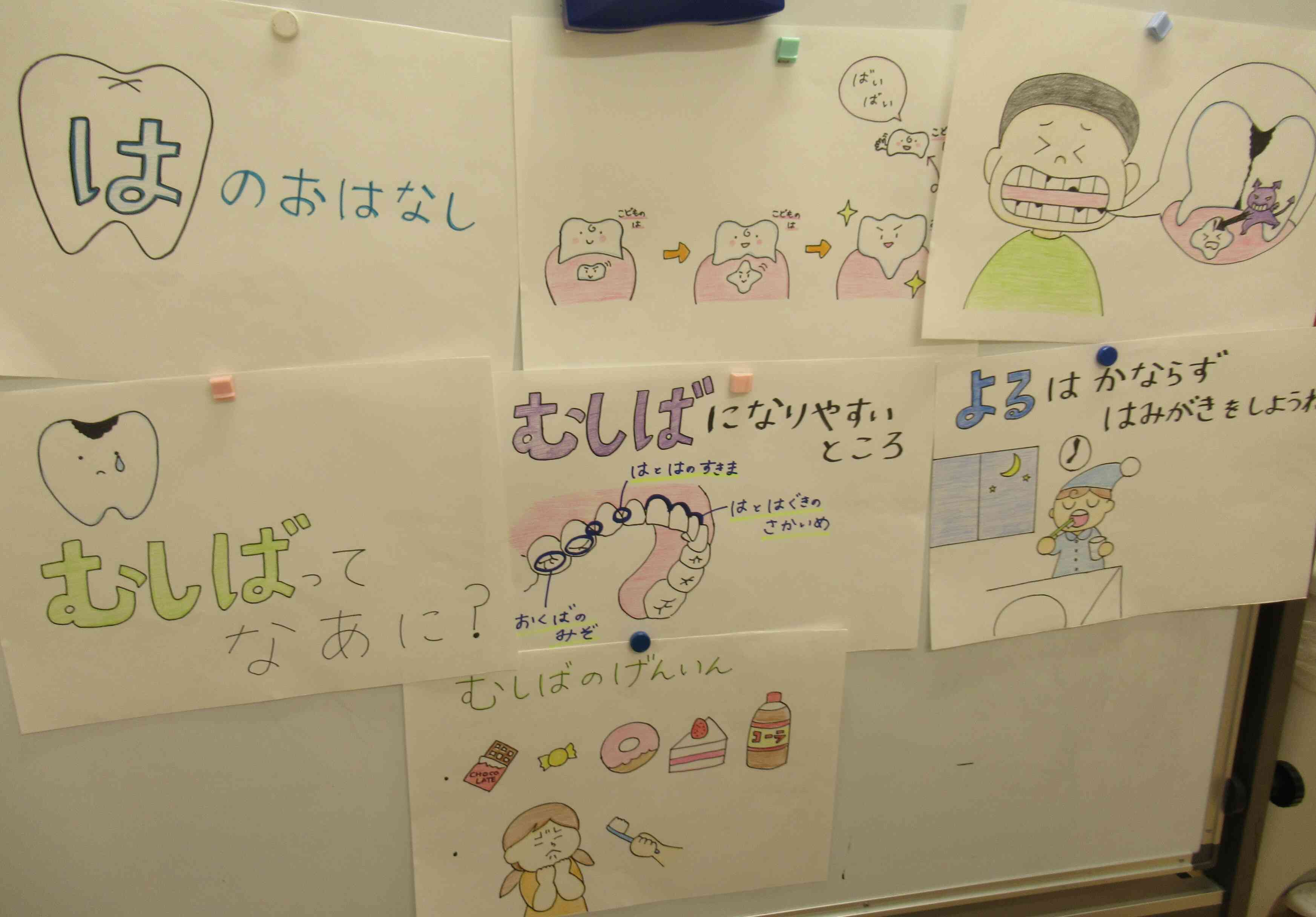 虫歯のお話～！
